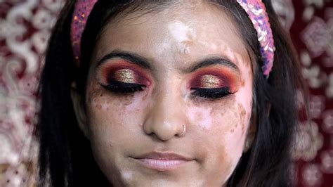 How To Cover Vitiligo In Makeup कोढ़ Easy Leukoderma Bridal Makeup