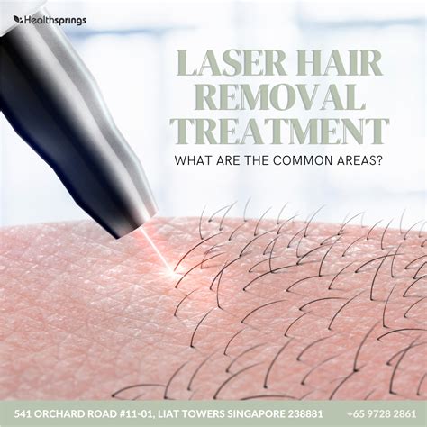 Common Areas For Laser Hair Removal Treatment