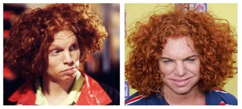 Plastic Surgery Before And After Carrot Top Plastic Surgery