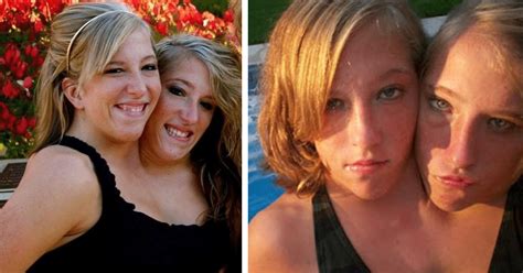 what conjoined twins abby and brittany hensel look like today jesus daily erofound