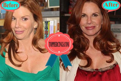 Melissa Gilbert Before And After Photos Top Piercings