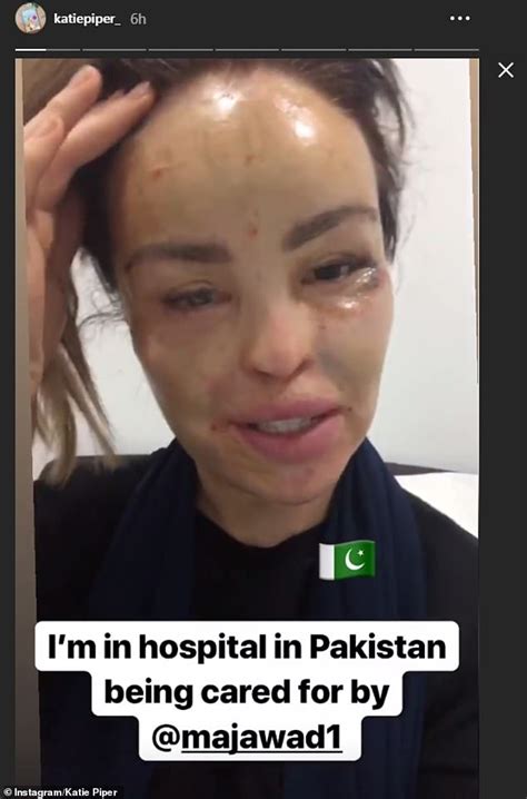 Katie Piper Is Recovering Well In Pakistan Hospital After Surgery Popular Indi News