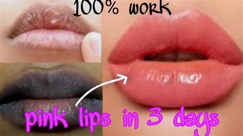 How To Get Pink Lips 👄 Naturally At Home Lighten Dark Pigmented