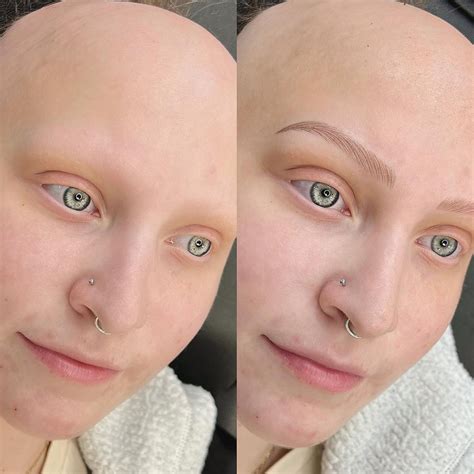 Microblading With No Eyebrows What Does It Look Like