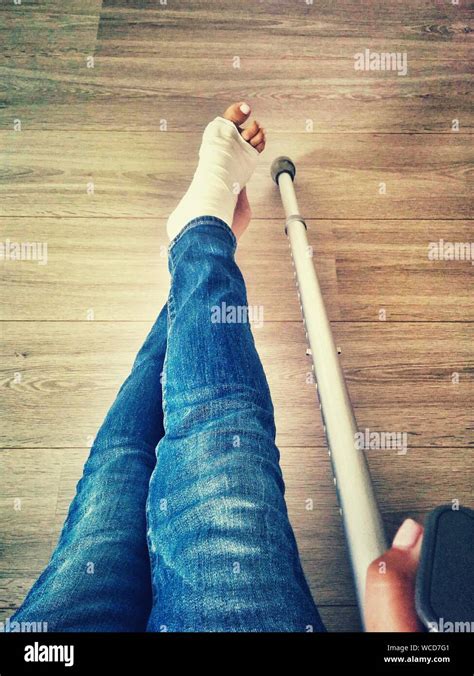 One Leg One Crutch Hi Res Stock Photography And Images Alamy