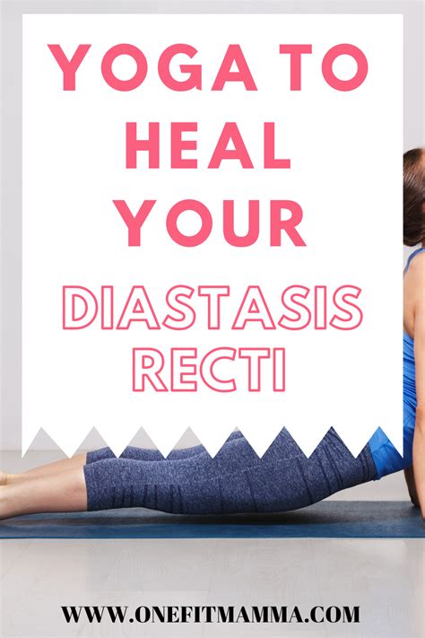 If You Have Diastasis Recti Especially After You Have Your Baby You