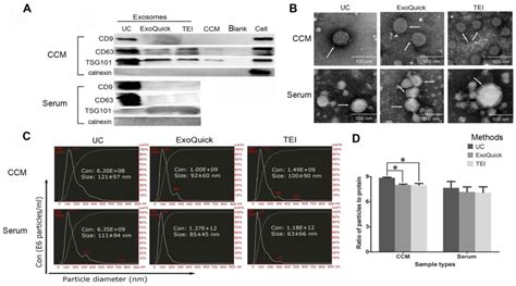 Comparison Of Isolation Methods Of Exosomes And Exosomal Rna From Cell