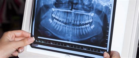 Radiología Dental Y Para Que Se Utilizan