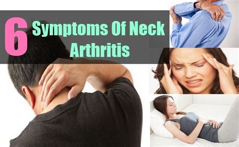 6 Symptoms Of Neck Arthritis Neck Arthritis Rheumatoid Arthritis