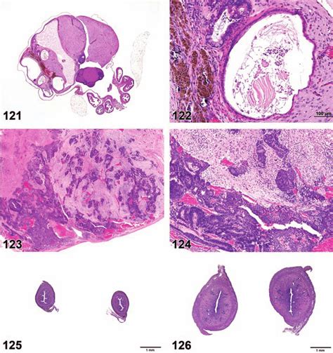 Teratoma Benign Ovary Mouse Figure 122 Teratoma Benign Ovary