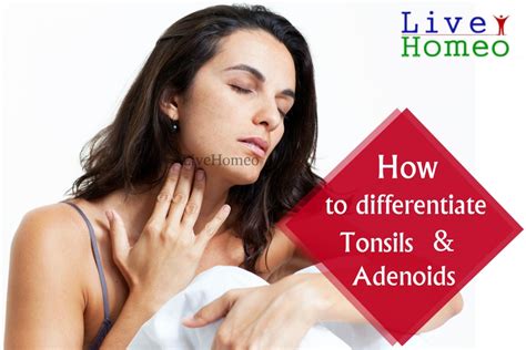 Tonsils And Adenoids Types Of Symptoms And Causes Live Homeo