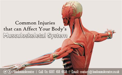 Musculoskeletal System London Musculoskeletal Centre Orthopedic And Sports Medicine