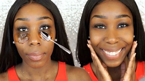 Diy How To Get Rid Of Dark Circles And Bags Under Eyes Fast Youtube