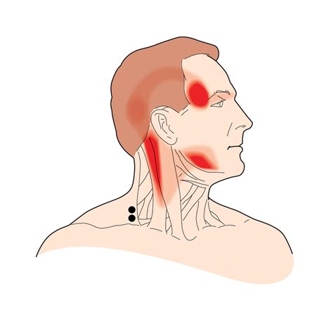 Treat Muscle Knot Pain In Neck And Head Tiger Tail Usa