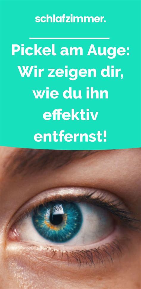 Hier ist alles was du über die unterschiedlichen arten von akne wissen musst, sowie die effektivsten wege pickel und mitesser loszuwerden. Pickel am Auge: Wir zeigen dir, wie du ihn effektiv ...