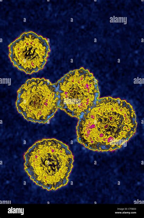 Virus De La RubÉola Fotografía De Stock Alamy