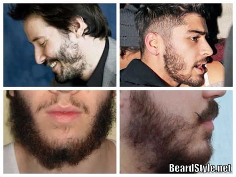 30 Spectacular Patchy Beard Styles For 2024 — Beard Style