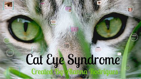 Cat Eye Syndrome By Alanna Rodrigues