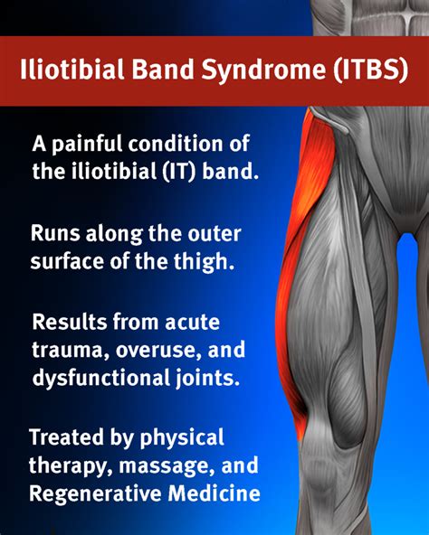 Iliotibial Band Syndrome Itbs Santa Cruz Core Fitness Rehab