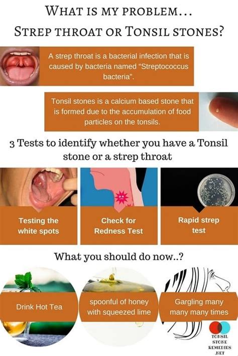 How To Remove Tonsil Stones In Toddlers Howotremvo