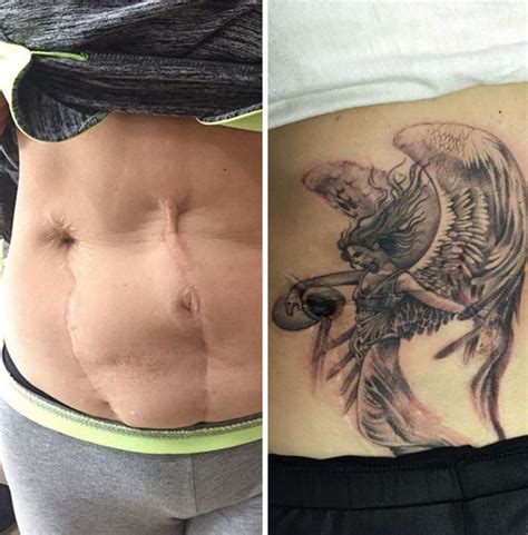 25 Incredibly Creative Tattoos That Cover Up Peoples Scars Tatuajes