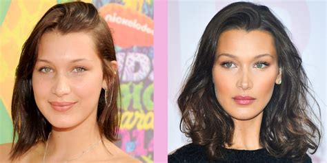 Bella Hadid Plastic Surgery The Supermodel Discussed Whether Shes
