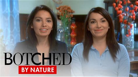 Botched By Nature Twins Need Help On Botched By Nature E Youtube