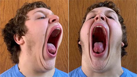 teen from pennsylvania has the world s largest mouth gape guinness world records