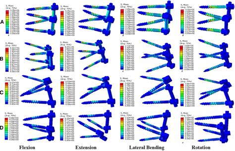 Frontiers Biomechanical Investigation Of The Hybrid Modified Cortical