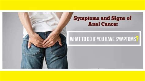 Anal Cancer Pictures