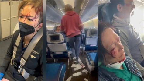 Severe Turbulence Injures Passengers On Hawaiian Flight Youtube