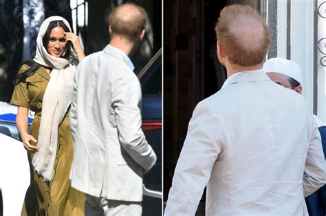 Prince Harrys Ever Thinning Hair On Show As He Breaks Cover Amid Royal