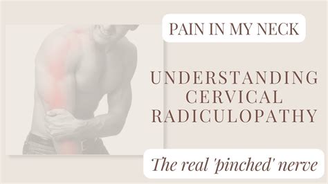 The Real Pinched Nerve Cervical Radiculopathy Youtube