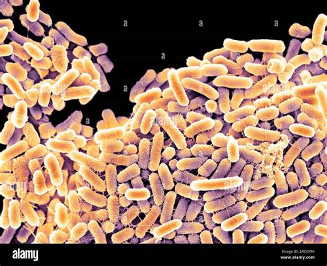 Salmonella Bacteria Coloured Scanning Electron Micrograph Sem These