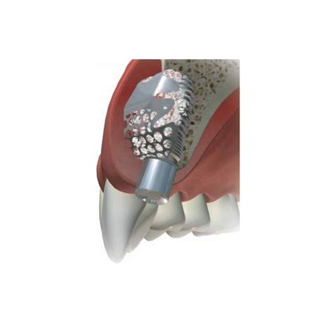 Dsi Dental Implant Titanium Surgical Barrier Membrane Mesh Plate 01mm