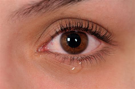 Watery Eyes In Adults Toddlers Causes Signs And Treatments American