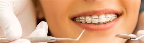 Dental Braces In Dubai Best Dentist Dubai Dental Implants Clear