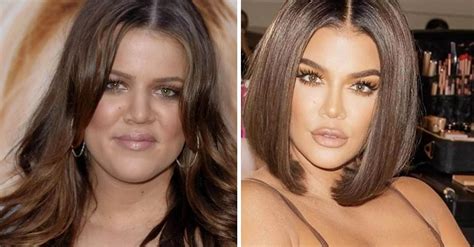Khloe Kardashian Debuts Drastic New Look Plastic Surgeons Weigh In