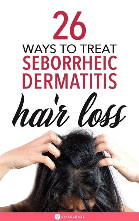 26 Effective Treatments For Seborrheic Dermatitis Hair Loss