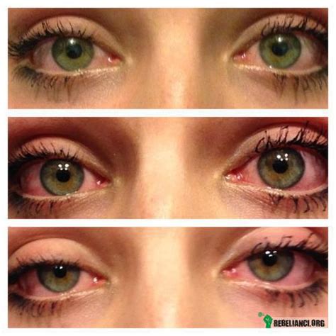 Marihuana A Przekrwione Oczy Czyli Nie Taki Diabeł Straszny