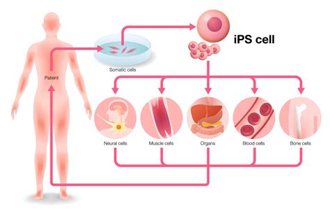 Células Madre Pluripotenciales Inducidas Ipscs Usando Bioimpresión