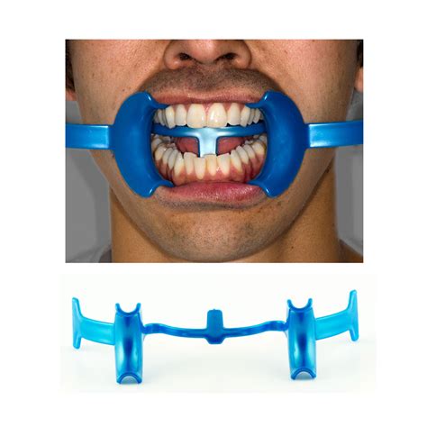 The Tcl Self Retaining Retractor Orthodontic Supply And Equipment Company