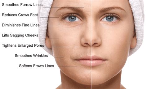 Stem Cellprp Facial Rejuvenation New Image Advanced Laser Skin