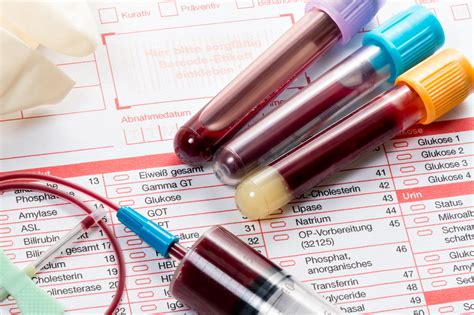 Blood Test Blood Samples On A Laboratory Form Truetest Labs