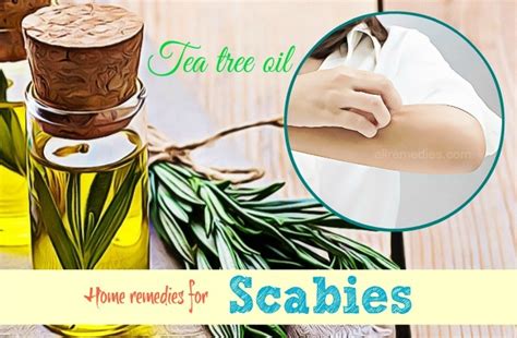 22 Science Backed Home Remedies For Scabies Itching On Human Skin