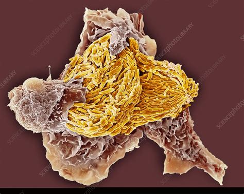 Macrophage Engulfing Tb Bacteria Sem Stock Image C0140596
