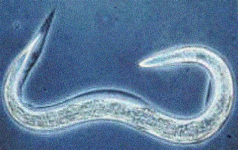 Destined To Die Roundworm Has A Self Destruct Program To Lower Its