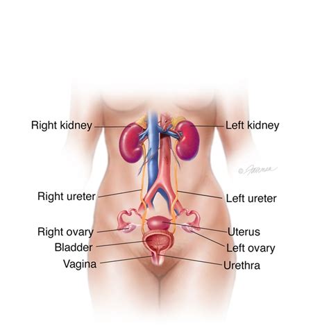 What Is Ectopic Ureter Urology Care Foundation