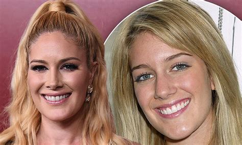 Heidi Montag Says Her Plastic Surgery Reveal On The Hills Is The Hardest Scene To Watch