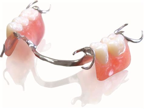 Affordable Dentures In Roseville California Ace Dental